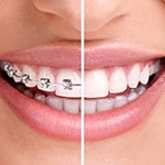 Orthodontics